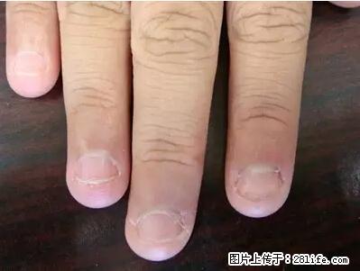 剪指甲、挖耳屎，这些日常小动作竟隐藏大危害！ - 果洛生活资讯 - 果洛28生活网 guoluo.28life.net